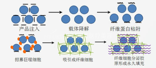 宝尼达解析